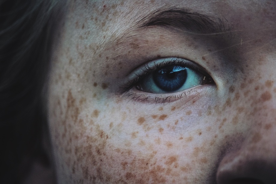 girl-freckles-blue-eyes